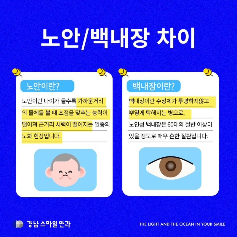 강남 노안수술 비용, 노안백내장 안과 고르는 법 사진 2