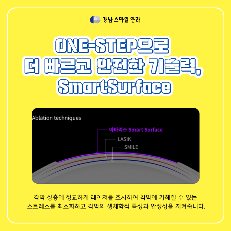 لازك تو داي في محطة جانجنام: ما هي تقنيات SmartSurface و SPT التي تسرع الشفاء؟
