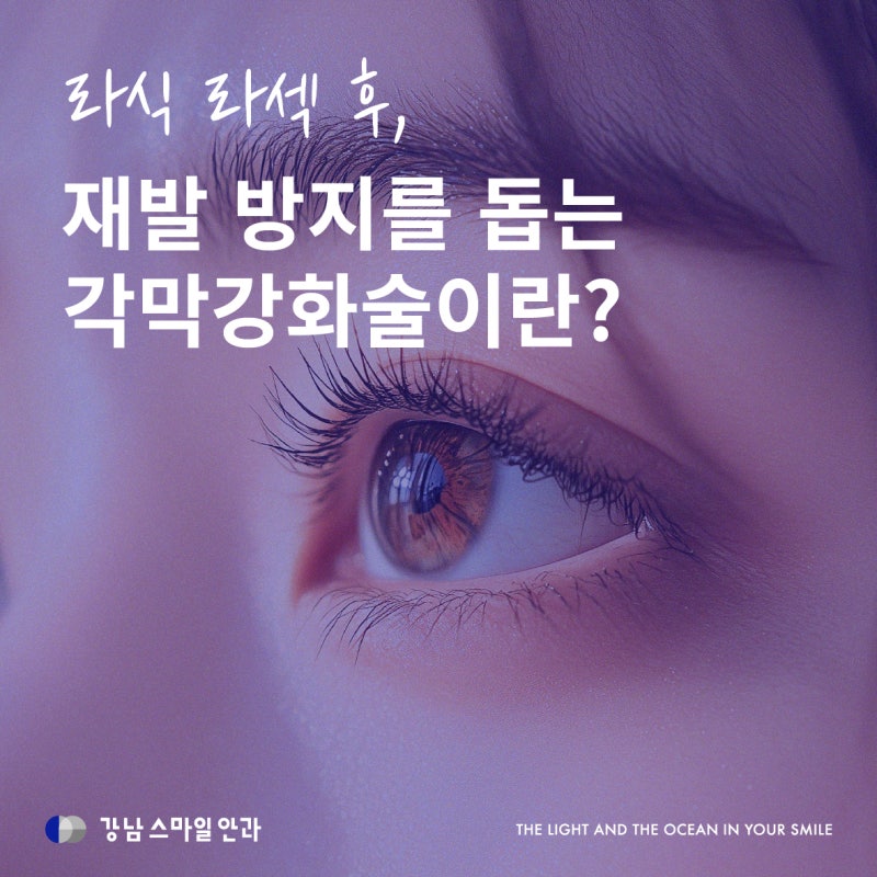 스마일라식 후 재발 방지를 돕는 '각막강화술' 이란?