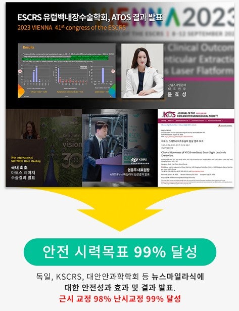 Tổng hợp các loại phẫu thuật điều trị tật khúc xạ tại Bệnh viện Mắt Gangnam Station! 사진 7