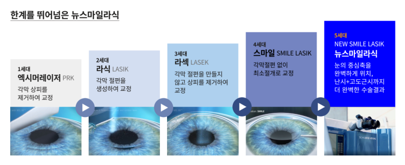 강남역안과에서 알아보는 시력교정술 종류 총정리! 사진 6