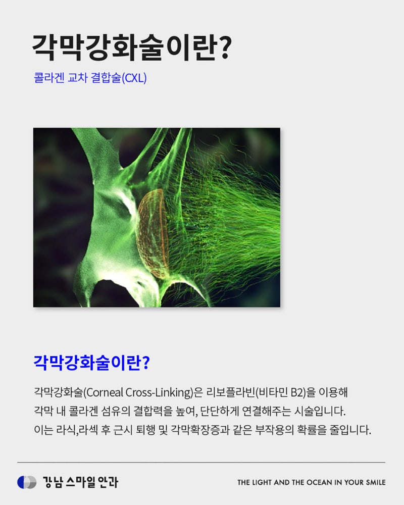 시력퇴행을 방지하는 각막강화술이란? | 강남역안과 사진 2