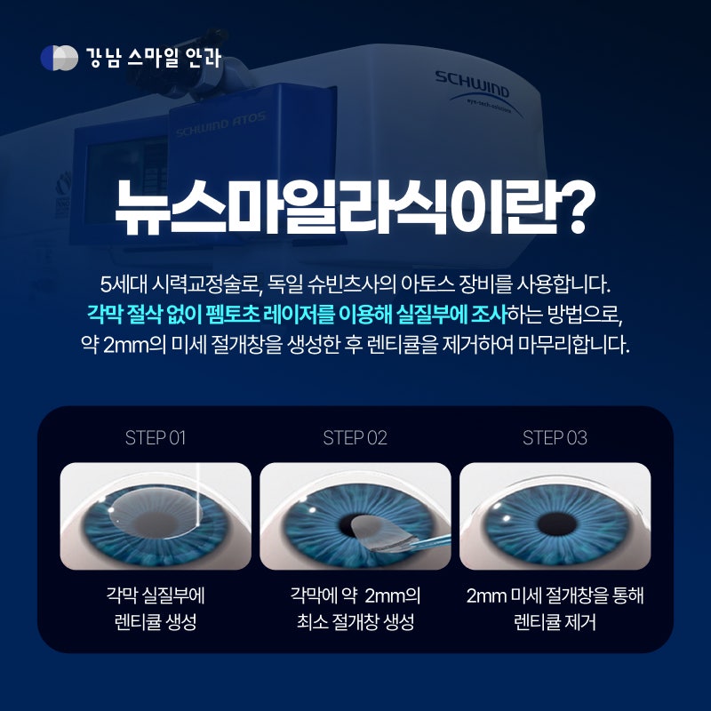 江南站眼科Smart LASIK的区别 (Feat.什么是New Smile LASIK?) 사진 2
