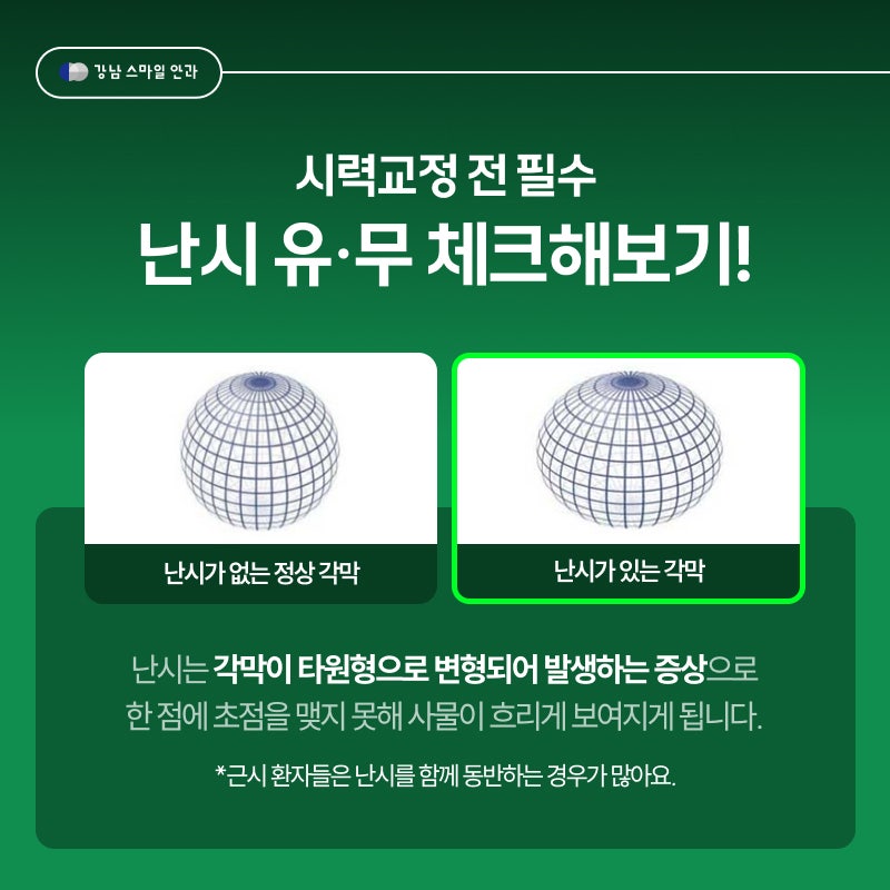 Tiêu chuẩn quyết định sự thành công của phẫu thuật Smile Lasik là gì? Bệnh viện Mắt Gangnam Smile 사진 3