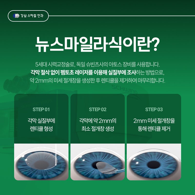 Tiêu chuẩn quyết định sự thành công của phẫu thuật Smile Lasik là gì? Bệnh viện Mắt Gangnam Smile 사진 2