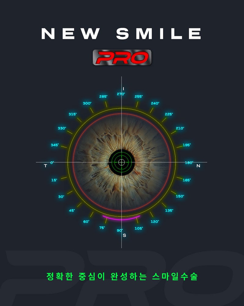 New SMILE Pro Differences | How Does It Differ from Existing New SMILE LASIK? 사진 3