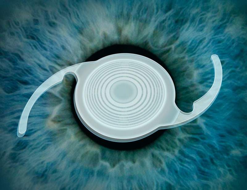 Why You Need to Carefully Choose a Hospital for Lens Implantation Surgery 사진 2