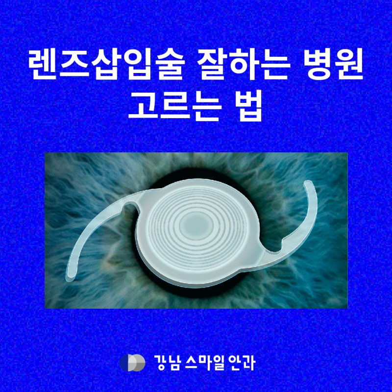 Why You Need to Carefully Choose a Hospital for Lens Implantation Surgery