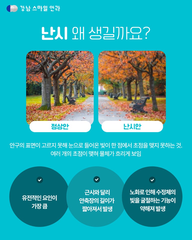 強度乱視、強度近視でもスマイルレーシックはおすすめ？ 사진 2