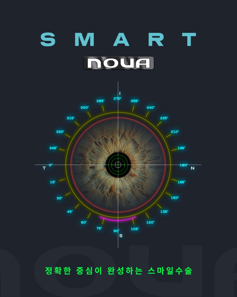 Phẫu thuật SMILE tiến hóa mới ✨SMART NOVA✨