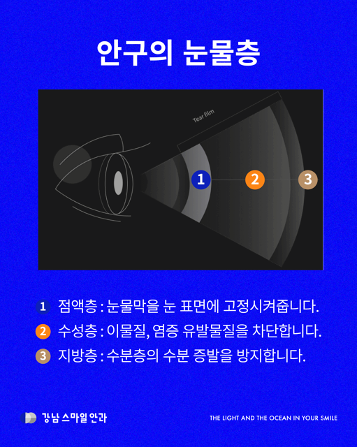 강남역안과에서 받는 안구건조증 IPL, 어떤 원리일까? 사진 2