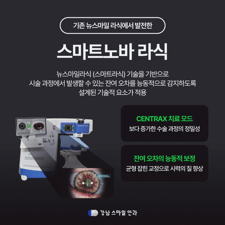 난시 교정까지 생각한다면? 서초동안과 스마트노바 라식 주목 사진 2